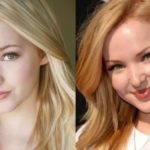 Dove Cameron plastic before and after surgery (14)