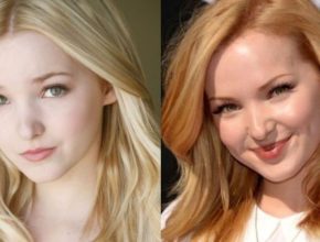 Dove Cameron plastic before and after surgery (14)