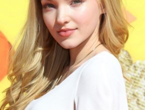 Dove Cameron plastic surgery (1)