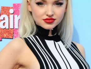 Dove Cameron plastic surgery (10)