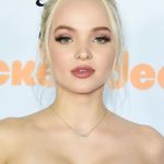 Dove Cameron plastic surgery (12)