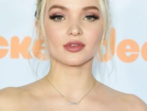 Dove Cameron plastic surgery (12)