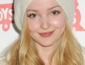 Dove Cameron plastic surgery (15)