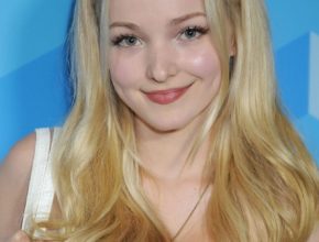 Dove Cameron plastic surgery (16)