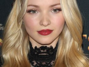 Dove Cameron plastic surgery (18)