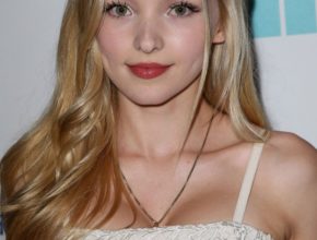 Dove Cameron plastic surgery (21)