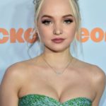 Dove Cameron plastic surgery (24)