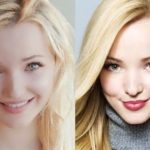 Dove Cameron plastic surgery (27)