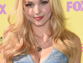 Dove Cameron plastic surgery (28)