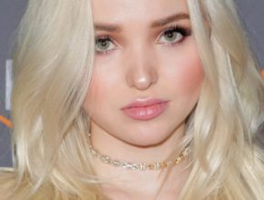 Dove Cameron plastic surgery