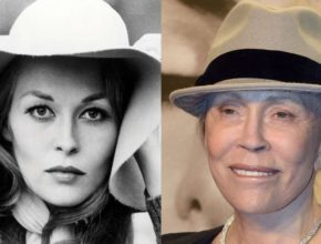 Faye Dunaway before and after plastic surgery