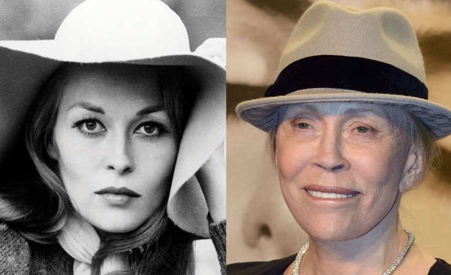 Faye Dunaway before and after plastic surgery