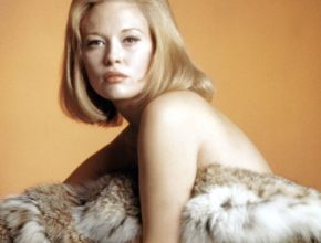 Faye Dunaway plastic surgery (1)