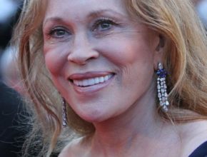 Faye Dunaway plastic surgery (11)