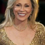 Faye Dunaway plastic surgery (21)