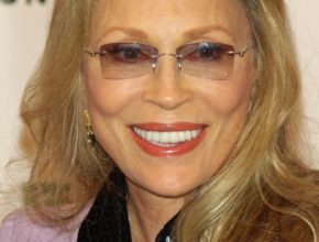 Faye Dunaway plastic surgery (28)