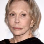 Faye Dunaway plastic surgery (29)