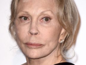 Faye Dunaway plastic surgery (29)