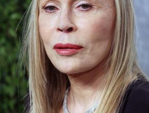 Faye Dunaway plastic surgery (3)