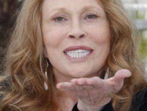 Faye Dunaway plastic surgery (32)