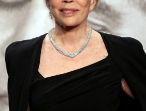 Faye Dunaway plastic surgery (33)