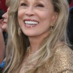 Faye Dunaway plastic surgery (34)