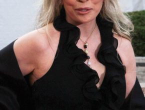 Faye Dunaway plastic surgery (39)