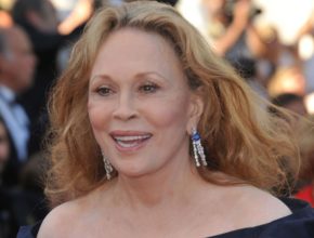 Faye Dunaway plastic surgery (41)