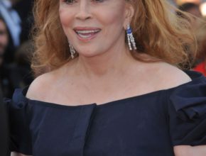 Faye Dunaway plastic surgery (43)