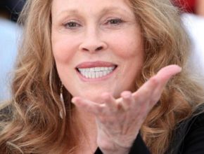 Faye Dunaway plastic surgery (44)