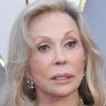 Faye Dunaway plastic surgery (47)