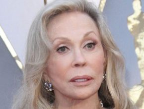 Faye Dunaway plastic surgery (47)