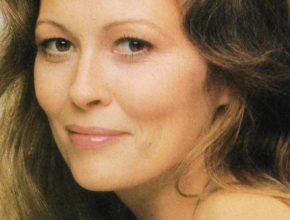 Faye Dunaway plastic surgery (8)