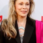 Faye Dunaway plastic surgery (9)