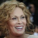 Faye Dunaway plastic surgery