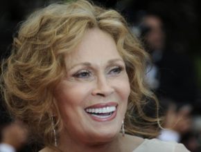 Faye Dunaway plastic surgery