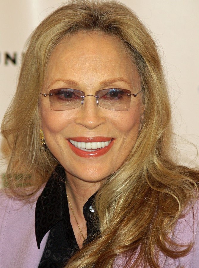 Faye Dunaway plastic surgery