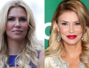 Brandi Glanville before and after plastic surgery