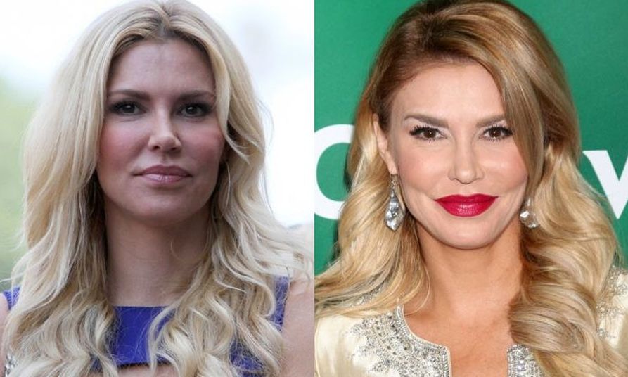 Brandi Glanville before and after plastic surgery