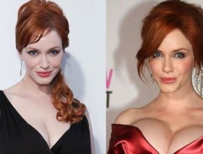 Christina Hendricks before and after plastic surgery
