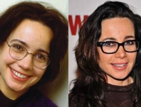 Janeane Garofalo before and after plastic surgery