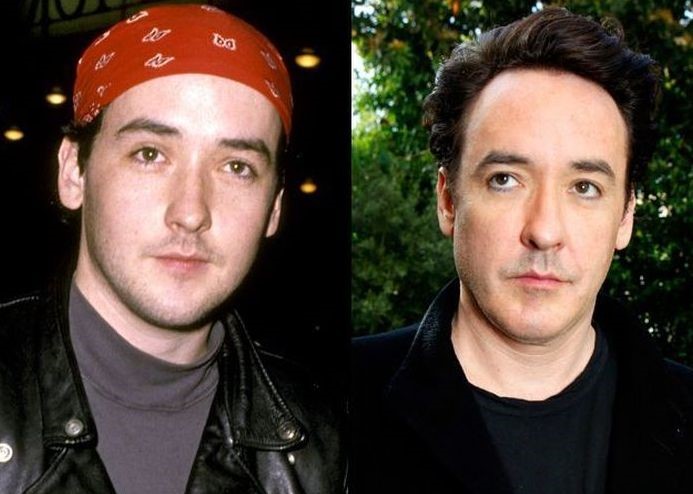 John Cusack before and after plastic surgery