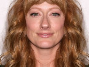 Judy Greer plastic surgery