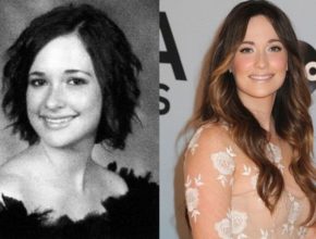 Kacey Musgraves before and after plastic surgery