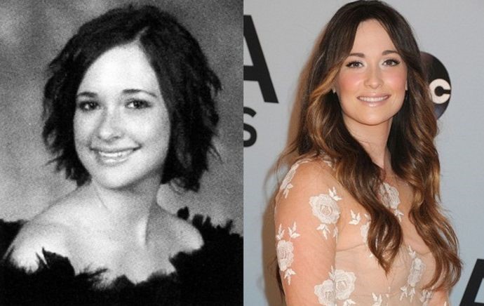 Kacey Musgraves before and after plastic surgery.
