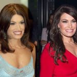 Kimberly Guilfoyle before and after plastic surgery
