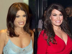 Kimberly Guilfoyle before and after plastic surgery