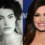 Kimberly Guilfoyle before and after plastic surgery