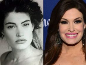 Kimberly Guilfoyle before and after plastic surgery