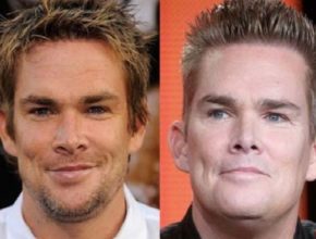 Mark McGrath before and after plastic surgery (10)
